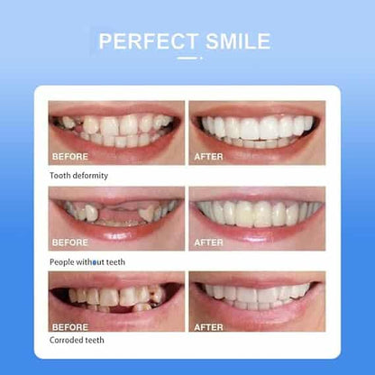 Snap On Smile Veneers Teeth For Men And Women Moldable False Artificial Braces Teeth